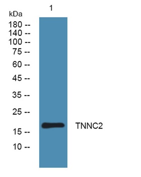 TNNC2 antibody