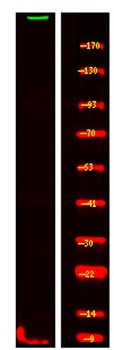 ASPM rabbit pAb Antibody