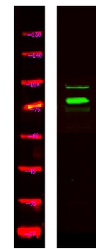 TSYL2 rabbit pAb Antibody