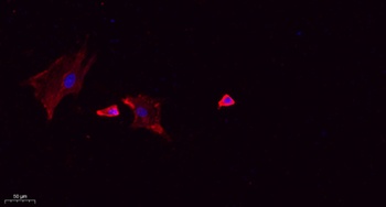 CLC10 rabbit pAb Antibody