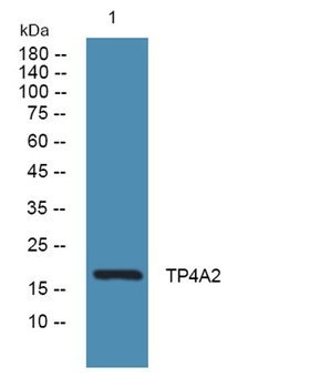 TP4A2 rabbit pAb Antibody