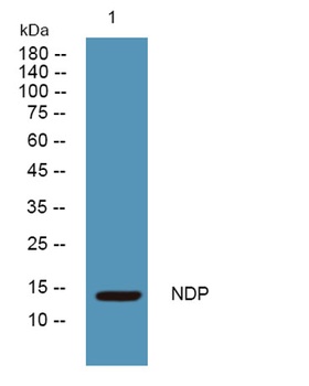 NDP rabbit pAb Antibody
