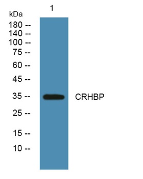 CRHBP rabbit pAb