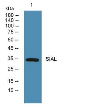 SIAL rabbit pAb Antibody