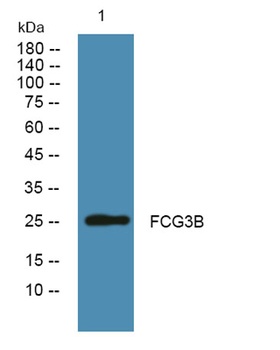 FCG3B rabbit pAb Antibody