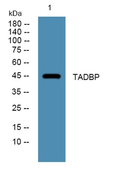 TADBP rabbit pAb Antibody