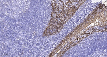 GPR98 antibody