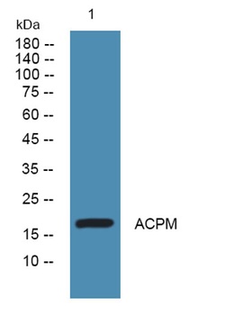 ACPM rabbit pAb Antibody