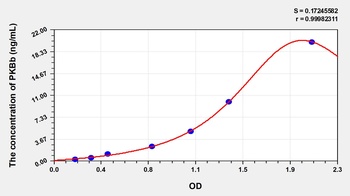 Human PKBb ELISA Kit