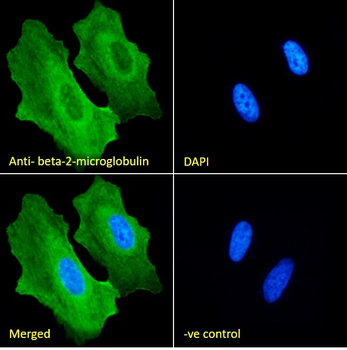 beta-2-microglobulin Antibody