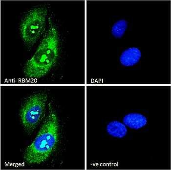 Goat anti-RBM20 (aa717-727) Antibody