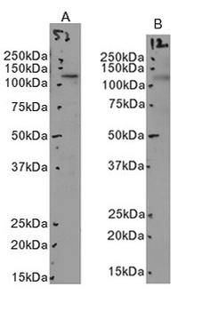 MERTK Antibody
