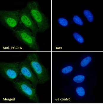 PPARGC1A Antibody