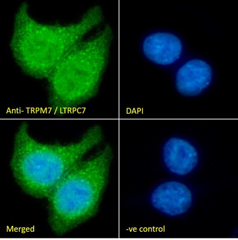 Goat anti-TRPM7 / LTRPC7 Antibody