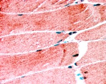 Goat anti-MURF1 / TRIM63 (N Term) Antibody