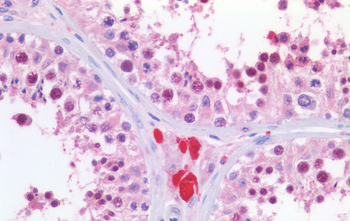 Goat anti-KPNA2 / IPOA1 Antibody