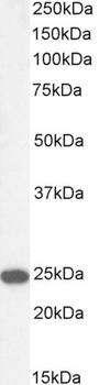 Goat anti-SM22 Alpha / Transgelin Antibody