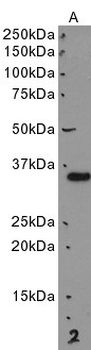 CBR3 Antibody