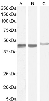 Smooth muscle alpha-actin