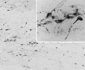 Goat anti-AGRP / Agouti-related protein Antibody