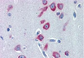Goat anti-PCK1 / PEPCKC (internal) Antibody