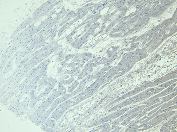 Goat anti-ADRB1 Antibody