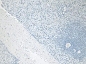 Goat anti-AIF1 / IBA1 (isoform 3) Antibody