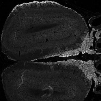 NCAM2 / OCAM