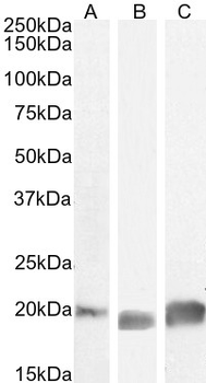 Goat anti-GPX4 (Isoform a and c) Antibody