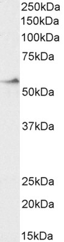 Goat anti-CRHR1 / CRF-R (aa 107 - 117) Antibody