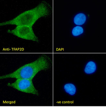 TFAP2D