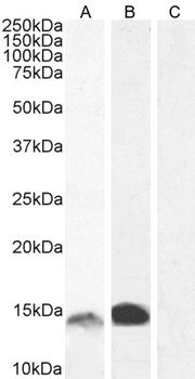 Goat anti-S100A9 Antibody