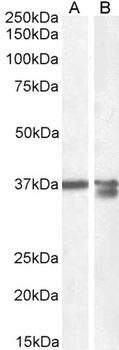 Goat anti-Arginase I Antibody