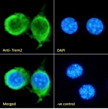 Trem2 antibody