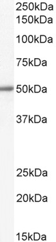 ALDH1B1