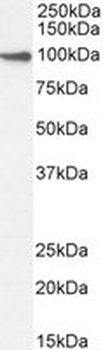 Positive Control Lysate for anti- BMP1 antibody