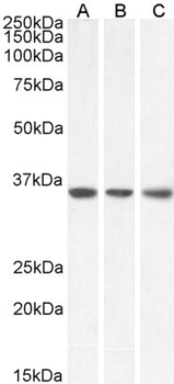 MDH2