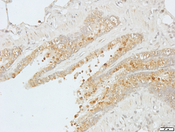 ACTN2 Rabbit Polyclonal Antibody