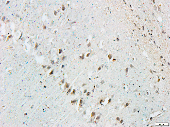 Caspase 3 Rabbit Polyclonal Antibody
