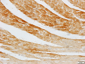 GAD1/2 Rabbit Polyclonal Antibody