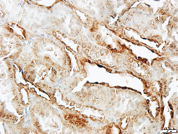 S100-A1 Rabbit Polyclonal Antibody