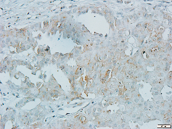 Alpha-adducin Rabbit Polyclonal Antibody