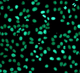 TUNEL Apoptosis Detection Kit (Green Fluorescence)