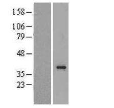 TAS2R3 Human Over-expression Lysate