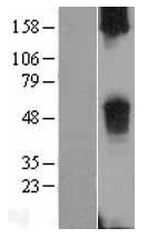 TAS2R38 Human Over-expression Lysate