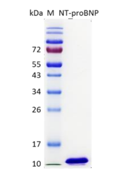 Human NT-proBNP Protein
