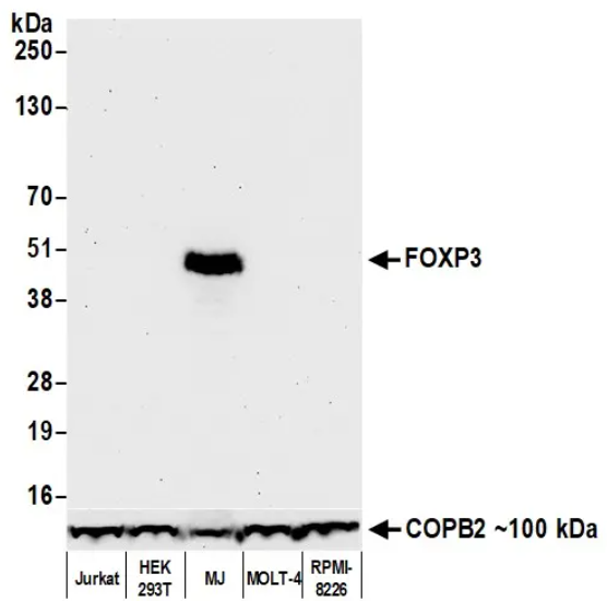 Rabbit anti-FOXP3 Recombinant Monoclonal Antibody