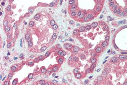 FGF23 Antibody