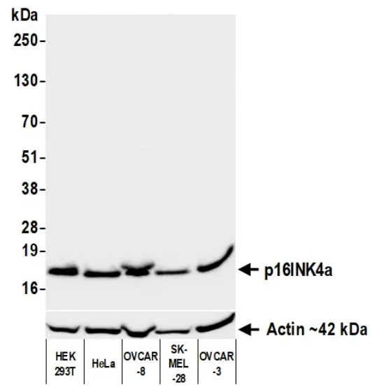 Rabbit anti-p16INK4a Recombinant Monoclonal Antibody