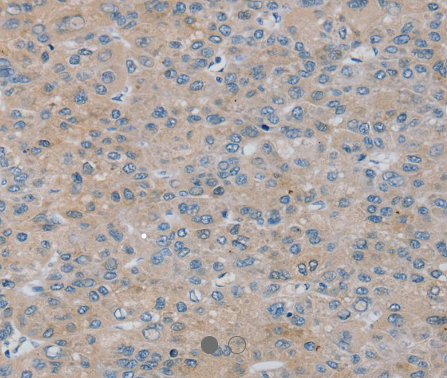 RASA4 Antibody